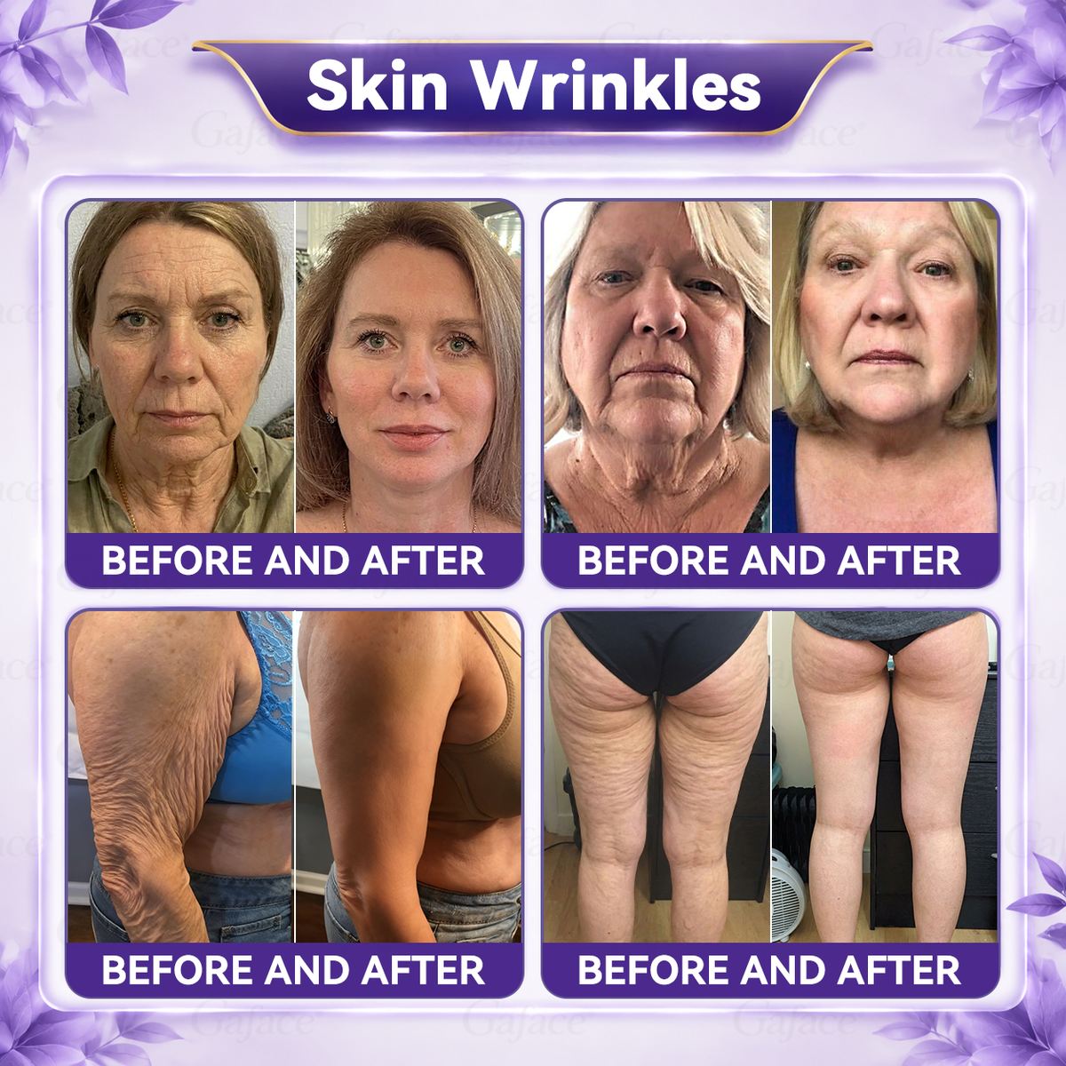 𝐆𝐀𝐅𝐀𝐂𝐄®💛𝐀𝐞𝐭𝐡𝐞𝐫𝐢𝐨𝐧-𝐗𝟗™ 𝟓-𝐏𝐨𝐢𝐧𝐭 𝐑𝐨𝐥𝐥𝐞𝐫 𝐅𝐢𝐫𝐦𝐢𝐧𝐠 𝐂𝐫𝐞𝐚𝐦 Quantum Ceramic Matrix · Collagen · Fullerene🧩